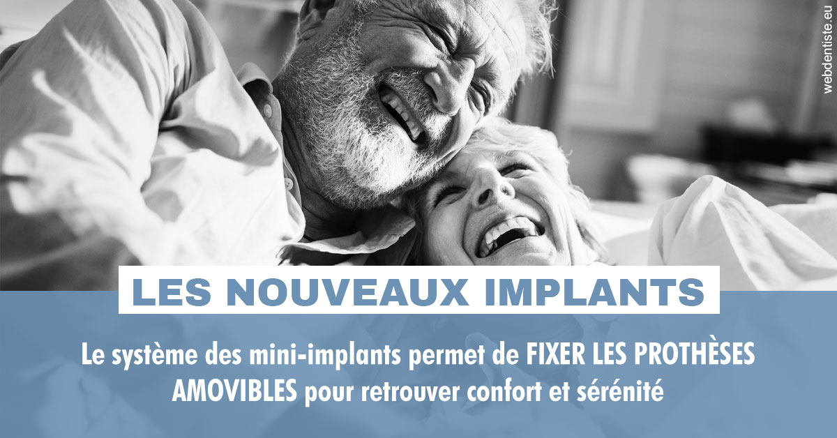 https://www.cabinet-dentaire-drlottin-drmagniez.fr/Les nouveaux implants 2