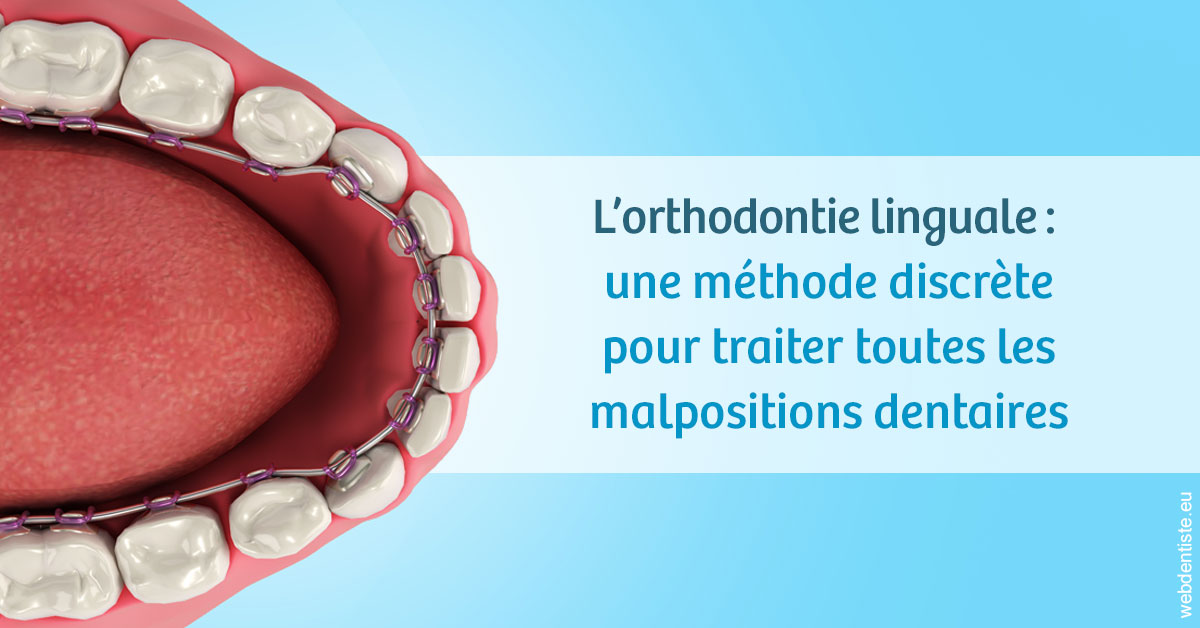 https://www.cabinet-dentaire-drlottin-drmagniez.fr/L'orthodontie linguale 1