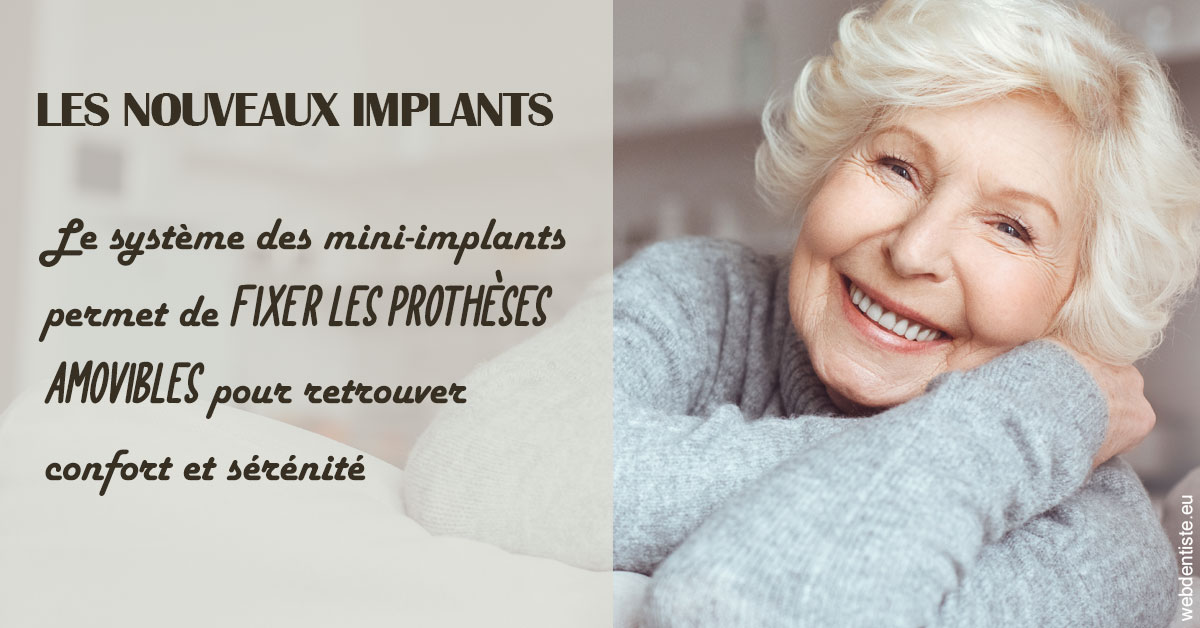 https://www.cabinet-dentaire-drlottin-drmagniez.fr/Les nouveaux implants 1