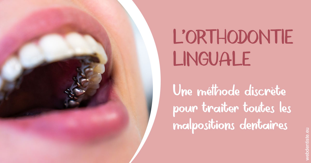 https://www.cabinet-dentaire-drlottin-drmagniez.fr/L'orthodontie linguale 2