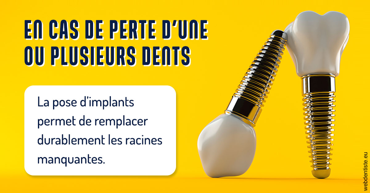 https://www.cabinet-dentaire-drlottin-drmagniez.fr/2024 T1 - Implants 02