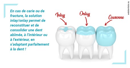 https://www.cabinet-dentaire-drlottin-drmagniez.fr/L'INLAY ou l'ONLAY