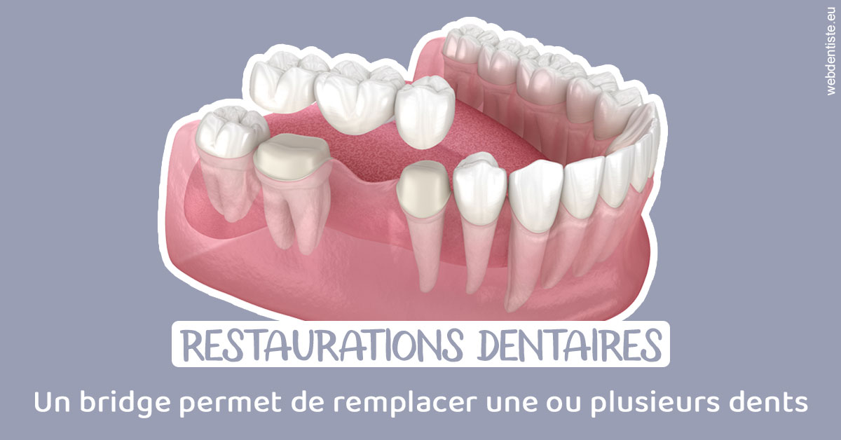 https://www.cabinet-dentaire-drlottin-drmagniez.fr/Bridge remplacer dents 1