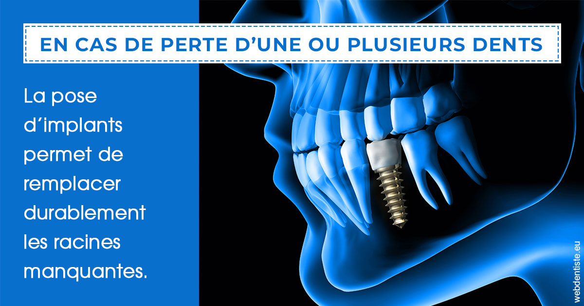 https://www.cabinet-dentaire-drlottin-drmagniez.fr/2024 T1 - Implants 01