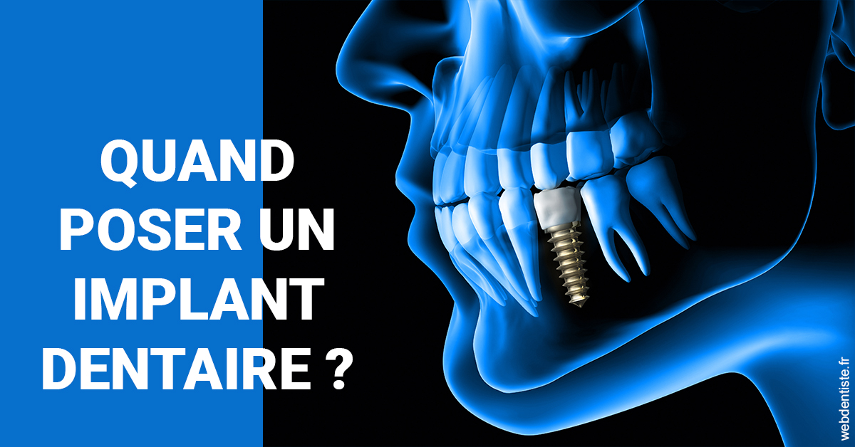 https://www.cabinet-dentaire-drlottin-drmagniez.fr/Les implants 1