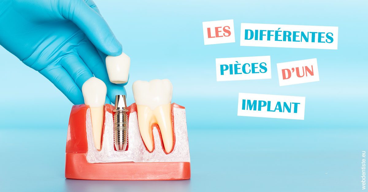 https://www.cabinet-dentaire-drlottin-drmagniez.fr/Les différentes pièces d’un implant 2