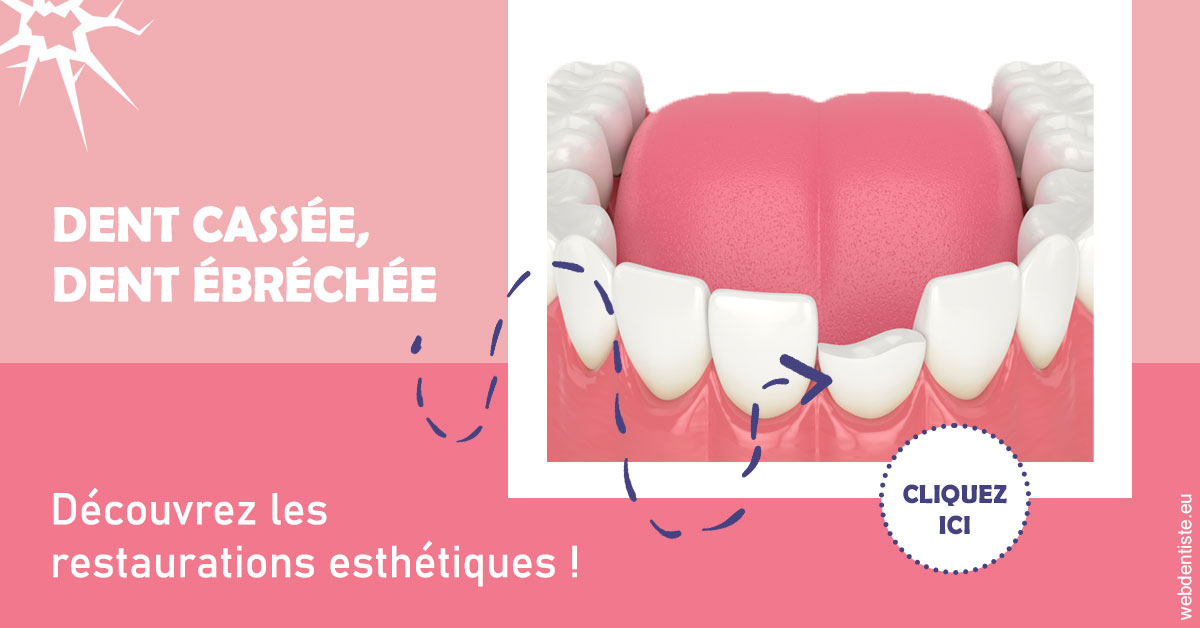 https://www.cabinet-dentaire-drlottin-drmagniez.fr/Dent cassée ébréchée 1