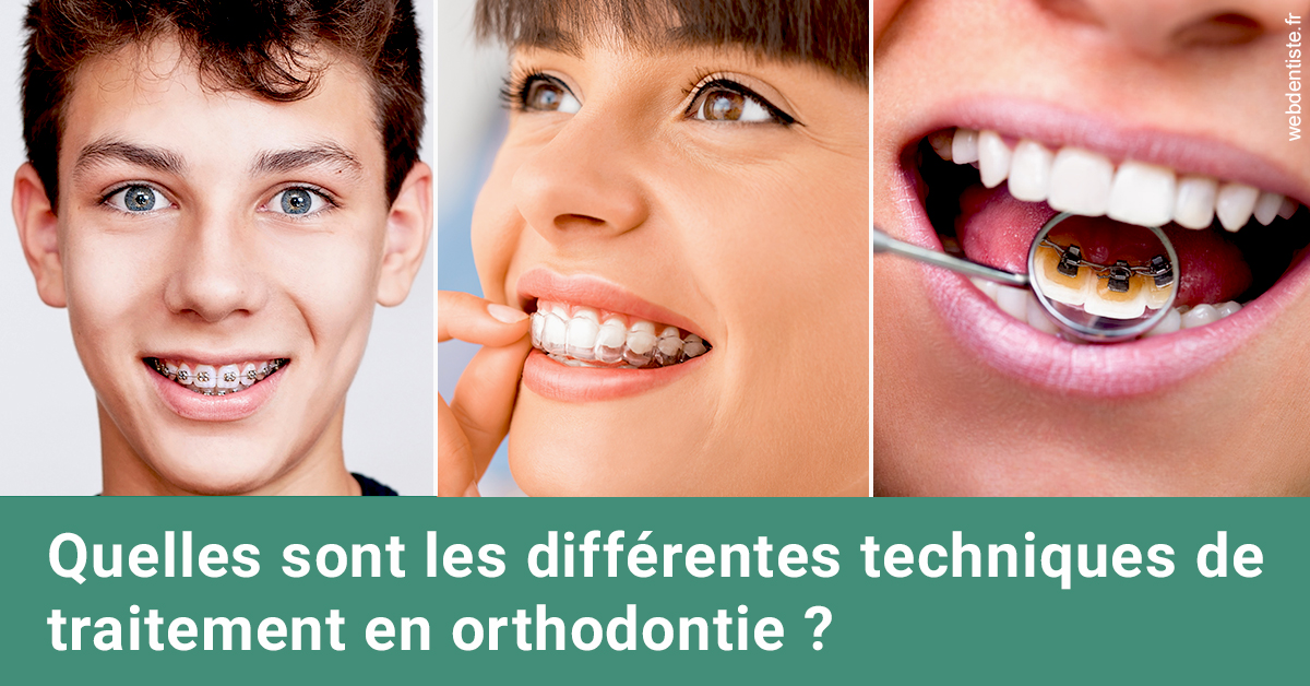 https://www.cabinet-dentaire-drlottin-drmagniez.fr/Les différentes techniques de traitement 2