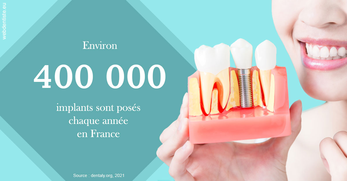 https://www.cabinet-dentaire-drlottin-drmagniez.fr/Pose d'implants en France 2