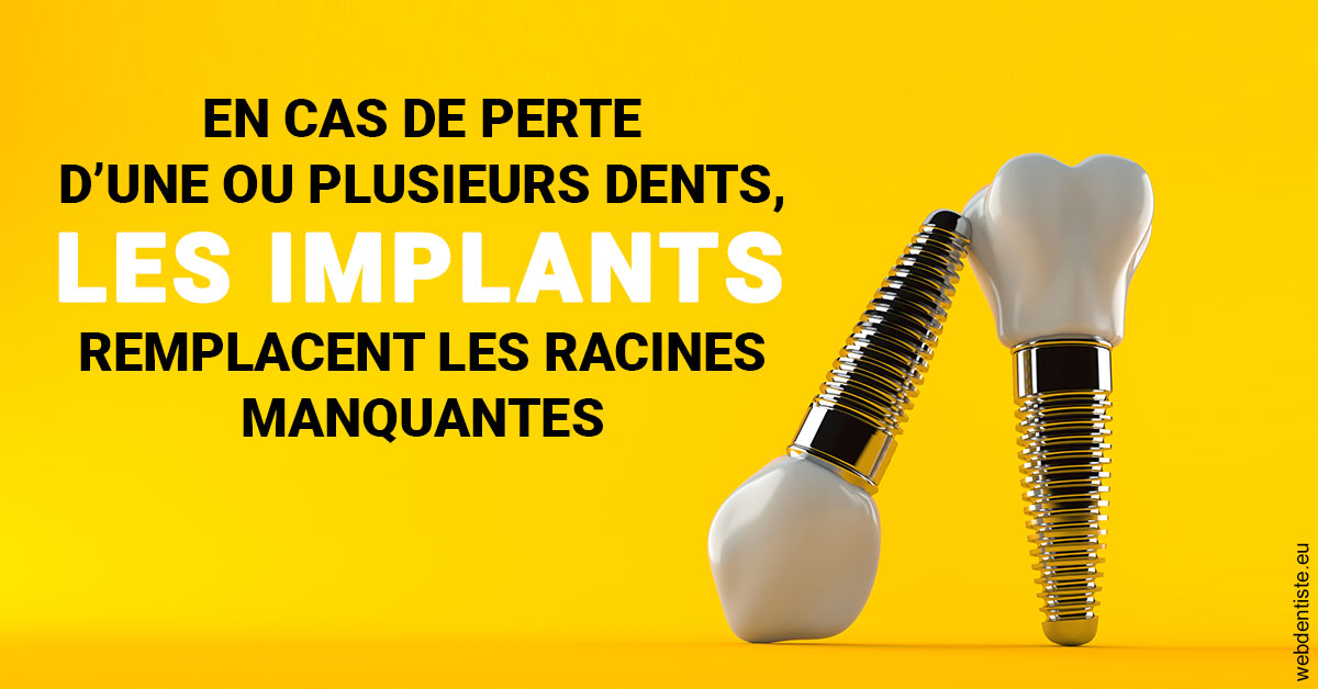 https://www.cabinet-dentaire-drlottin-drmagniez.fr/Les implants 2