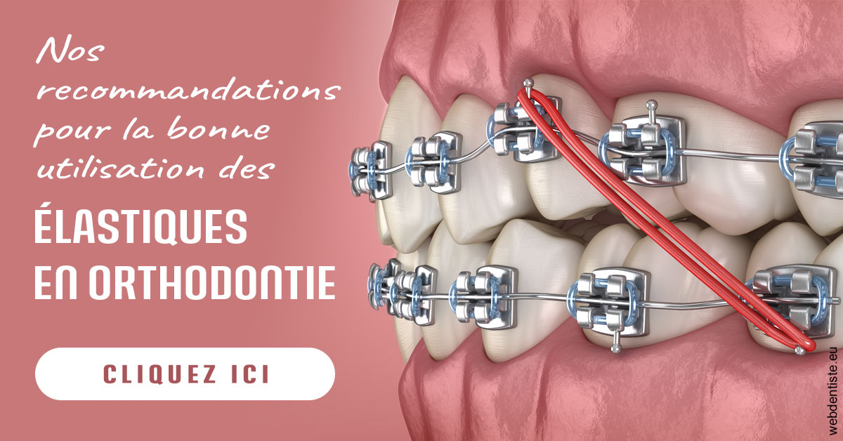 https://www.cabinet-dentaire-drlottin-drmagniez.fr/Elastiques orthodontie 2